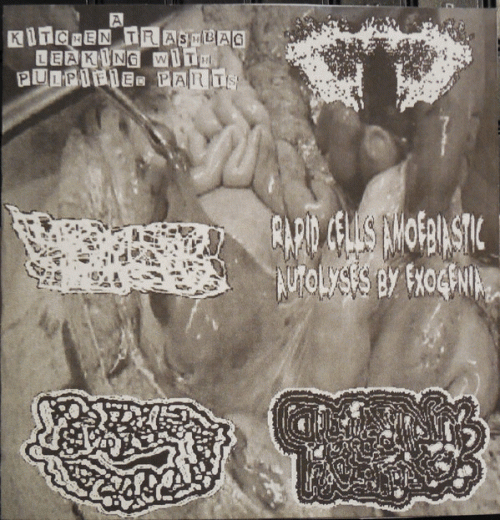 Carcinomas Of Unknown Primary Origin : 6-Way Split